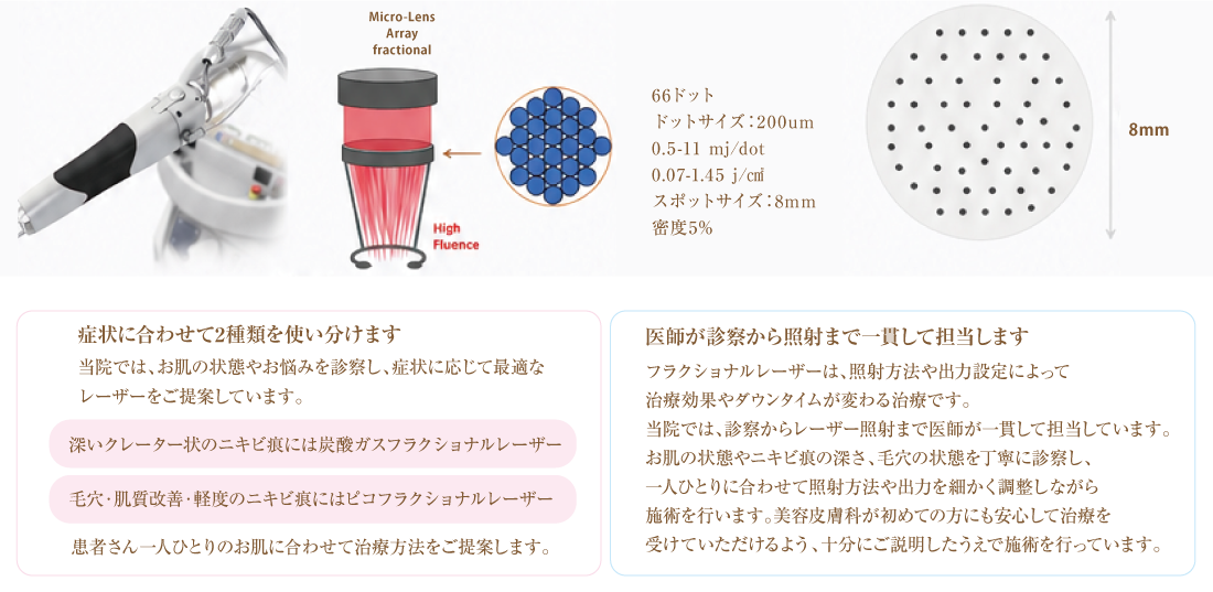 ASCE+ HRLV療法
