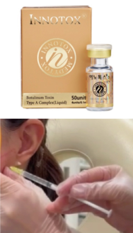 レーザーシャワー